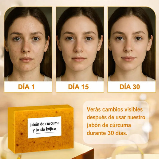 🔥 SOLO HOY 🚨 2x1  en Jabón de Cúrcuma & Ácido Kójico 🧼✨ | Elimina manchas y luce una piel radiante 💛 + Envío GRATIS 🚚